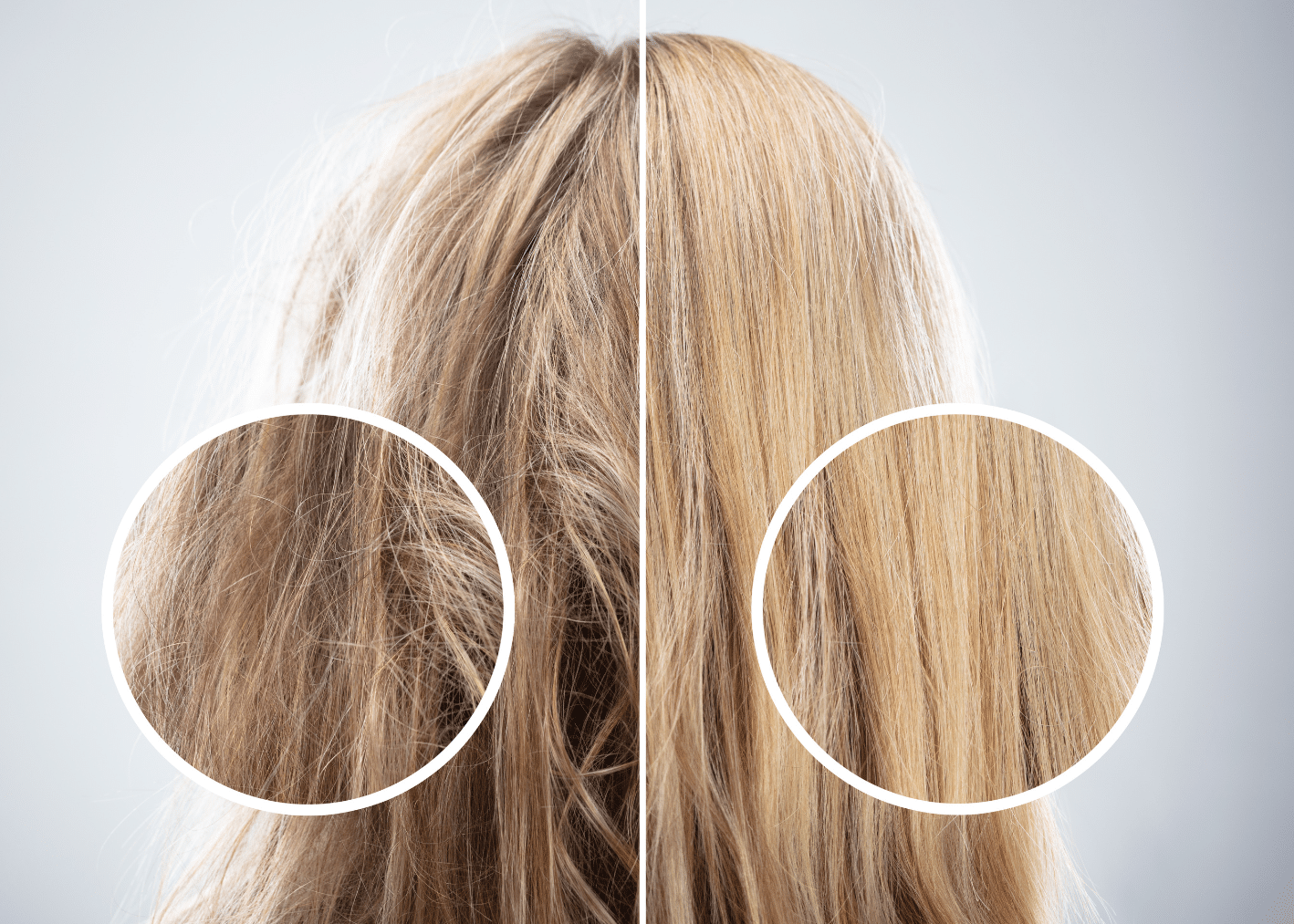 The Ultimate Guide to Managing Frizzy Hair – Windle London